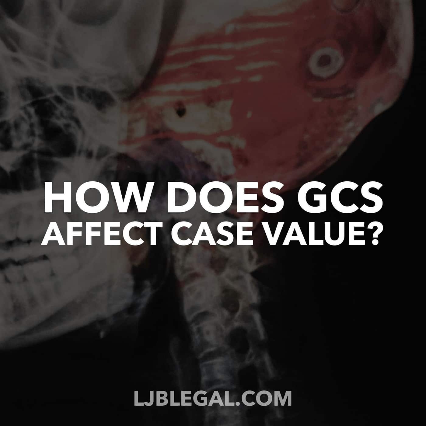 How GCS Scores Influence Compensation for Brain Injury Victims in Louisiana