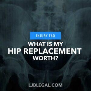 How Much is my Hip Replacement Worth After a Car Accident in Louisiana?