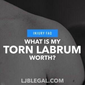 What is My Torn Labrum Shoulder Injury Worth?