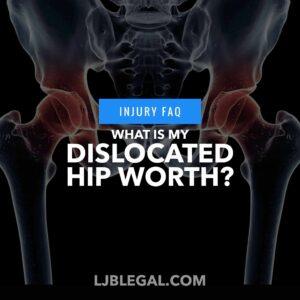 How Much is my Dislocated Hip Claim Worth After a Car Accident in Louisiana?